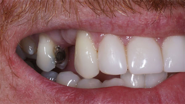 Before dental treatment