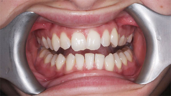 Before dental treatment