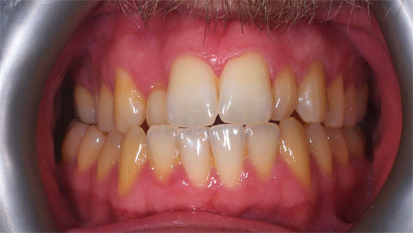 Before dental treatment