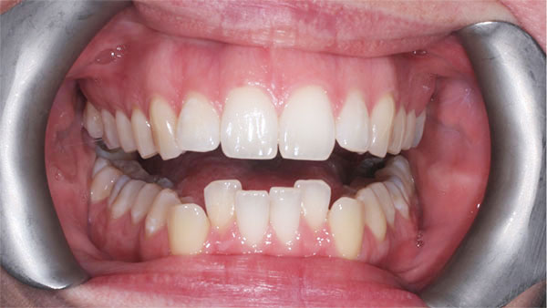 Before dental treatment