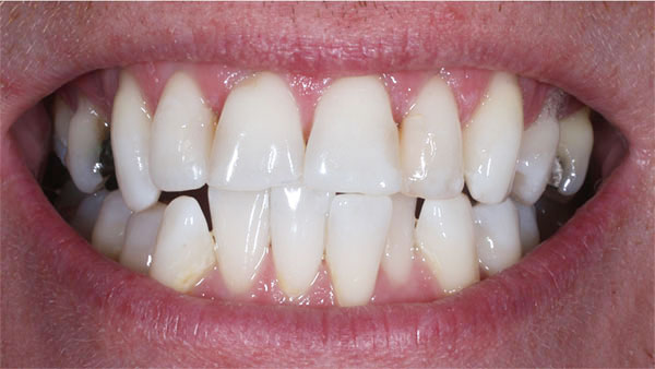 Before dental treatment